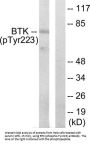 Tyrosine-Protein Kinase BTk Phospho-Tyr223 (BTK pY223) Antibody