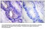 Protein Kinase, cAMP Dependent Catalytic Alpha/Beta Phospho-Thr197 (PRKACA/PRKACB pT197) Antibody