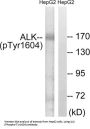 ALK Tyrosine Kinase Receptor Phospho-Tyr1604 (ALK pY1604) Antibody