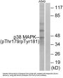 Mitogen-Activated Protein Kinase 14 Phospho-Thr180/Tyr182 (MAPK14 pT180/Y182) Antibody