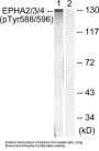 EPHA2 / 3 (Phospho-Tyr588 / 596) Antibody