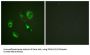 EPHA2 / 3 (Phospho-Tyr588 / 596) Antibody