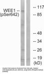 Wee1-Like Protein Kinase Phospho-Ser642 (WEE1 pS642) Antibody