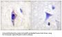 PI3-kinase p85 alpha Phospho-Tyr607 (PIK3R1 pY607) Antibody