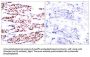 Transcription Factor Jun B Phospho-Ser79 (JunB pS79) Antibody