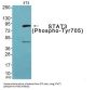 Signal Transducer and Activator of Transcription 3 Phospho-Tyr705 (STAT3 pY705) Antibody