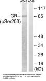 GR (Phospho-Ser203) Antibody