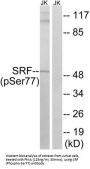 Serum Response Factor Phospho-Ser77 (SRF pS77) Antibody