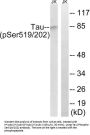 Microtubule-Associated Protein Tau Phospho-Ser519/202 (MAPT pS519/202) Antibody