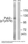 Protein-Tyrosine Kinase 2-Beta Phospho-Tyr579 (PTK2B pY579) Antibody