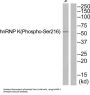 hnRNP K (Phospho-Ser216) Antibody