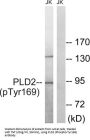 Phospholipase D2 Phospho-Tyr169 (PLD2 pY169) Antibody