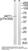 RAC-Alpha Serine/Threonine-Protein Kinase Phospho-Thr308 (AKT1 pT308) Antibody