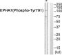 EPHA7 (Phospho-Tyr791) Antibody