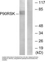 90 kDa Ribosomal Protein S6 Kinase 1 (p90 RSK) Antibody