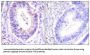 90 kDa Ribosomal Protein S6 Kinase 1 (p90 RSK) Antibody