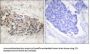 Steroidogenic Factor 1 (SF1) Antibody