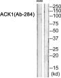 Activated CDC42 Kinase 1 (ACK1) Antibody