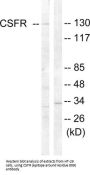 Macrophage Colony-Stimulating Factor 1 Receptor (CSF1R) Antibody