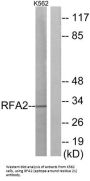 Replication Factor A Protein 2 (RFA2) Antibody
