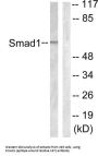 Mothers Against Decapentaplegic Homolog 1 (Smad1) Antibody
