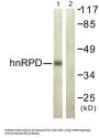 Heterogeneous Nuclear Ribonucleoprotein D0 (hnRPD) Antibody