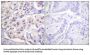 Heterogeneous Nuclear Ribonucleoprotein D0 (hnRPD) Antibody