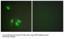 Heterogeneous Nuclear Ribonucleoprotein D0 (hnRPD) Antibody