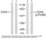 Serine/threonine-Protein Kinase Chk2 (CHK2) Antibody