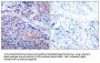 Ik B Alpha (IKBA) Antibody