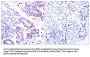 Signal Transducer And Activator of Transcription 1 (STAT1) Antibody