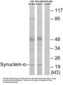 Alpha Synuclein (SNCA) Antibody