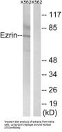 Ezrin (EZR) Antibody