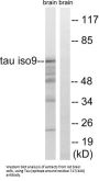 Microtubule-Associated Protein Tau (MAPT) Antibody