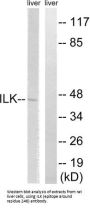 Integrin-Linked Protein Kinase (ILK) Antibody