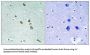 Integrin-Linked Protein Kinase (ILK) Antibody