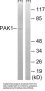 Serine/threonine-Protein Kinase PAK 1 (PAK1) Antibody