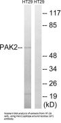 P21 Protein Activated Kinase 2 (PAK2) Antibody