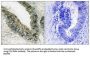 Eukaryotic Translation Initiation Factor 2 Alpha Kinase 3 (EIF2AK3) Antibody