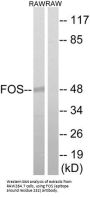 Proto-Oncogene C-Fos (FOS) Antibody