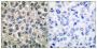 Catenin Gamma (CTNNG) Antibody