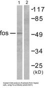Proto-Oncogene C-Fos (FOS) Antibody