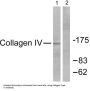 Collagen Type IV Alpha 1 (COL4A1) Antibody