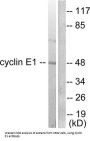 Cyclin E1 (CCNE1) Antibody