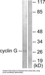 Cyclin G (CycG) Antibody