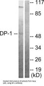 Transcription Factor Dp-1 (DP-1) Antibody