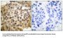 Mitogen-Activated Protein Kinase 1 and 3 / ERK1/2 (MAPK1/MAPK3) Antibody