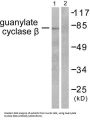 Guanylate Cyclase beta Antibody