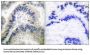 Guanylate Cyclase beta Antibody