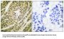 Histone Deacetylase 5 (HDAC5) Antibody